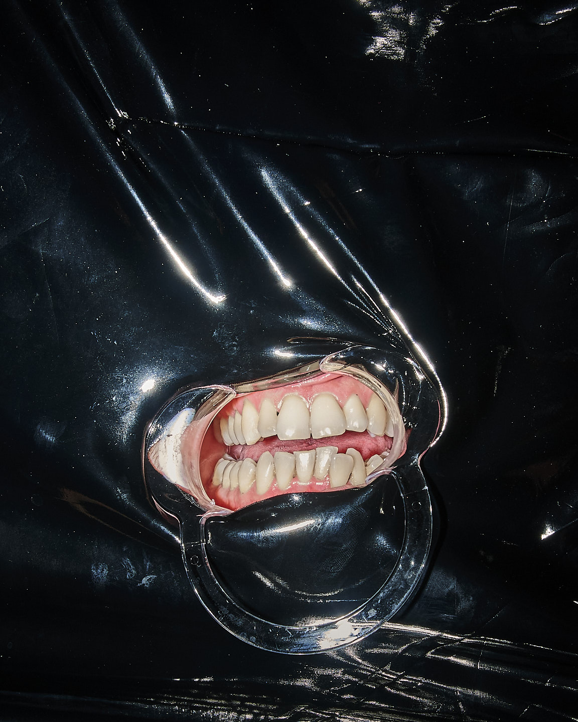 Image 2 of 8 from Dinner Sessions: Dental portraits - Click to view full size